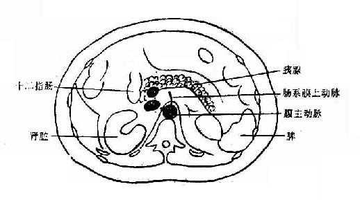 腹部横断层面图象