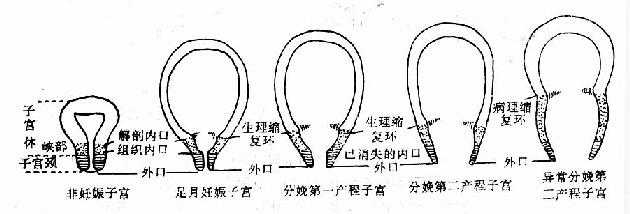 宫颈扩张及子宫下段形成