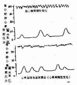 胎心率与基线摆动