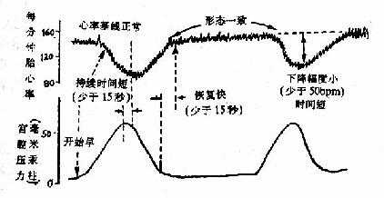 PFHR 早期减速