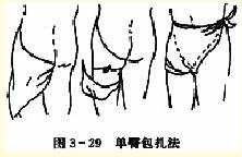  单臀三角巾包扎法