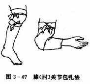  膝（肘）关节毛巾包扎法