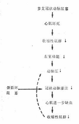 冠状动脉阻塞引起心源性休克和进行性循环衰竭的恶性循环