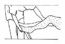 足背屈协同动作的分离