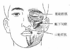 眶下蜂窝织炎发生的部位