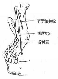 下牙槽神经、颊神经、舌神经位置示意图