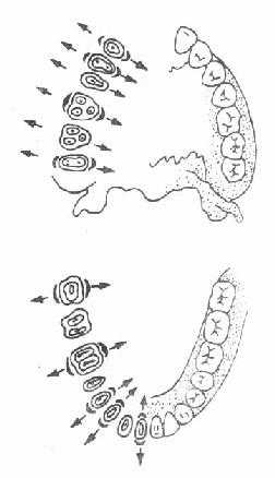 用牙钳拔牙时的摇动方向示意图