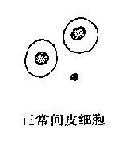 各种异形间皮细胞