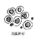 各种异形间皮细胞