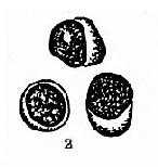 正常淋巴结穿刺涂片常见手细胞