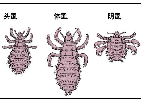 虱的外形
