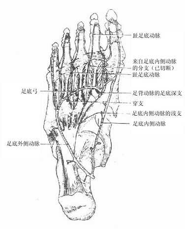 足底弓