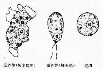 齿龈阿米巴