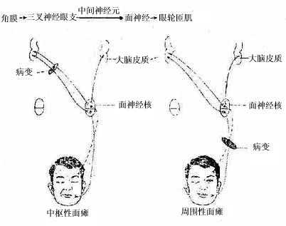 面神经核的核上支配