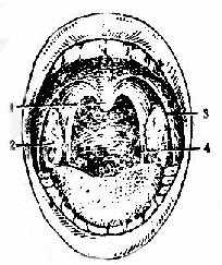 扁桃体位置及其大小分度示意图