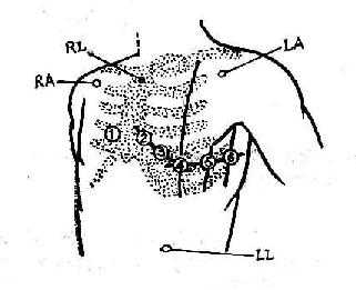 活动平板试验电极放置位置示意图