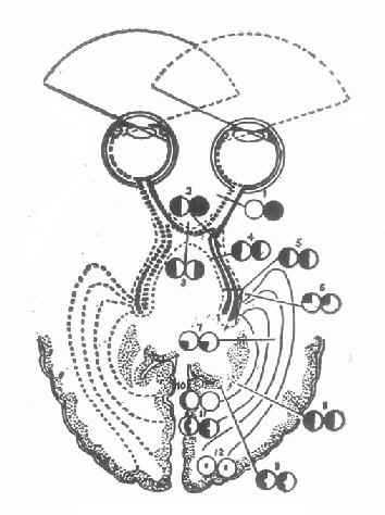 视路疾患视野改变示意图