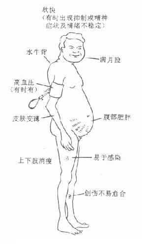长期服用糖皮质激素后的不良反应示意图