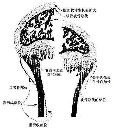 骨干骨密质形成和外形变化及骨骺发育示意图 