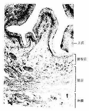人输尿管 