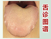 舌诊图谱