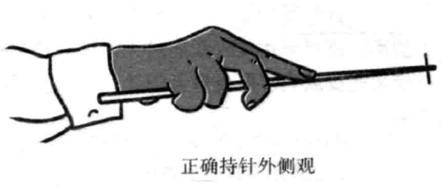 梅花针正确持针外侧观