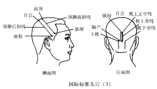 国际标准头穴