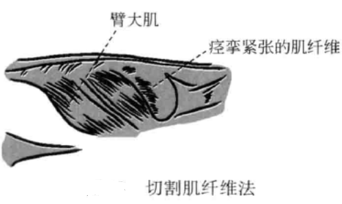 切割肌纤维法