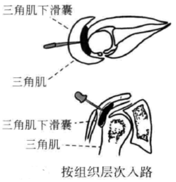 按组织层次入路
