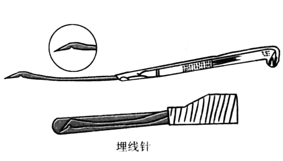 埋线针