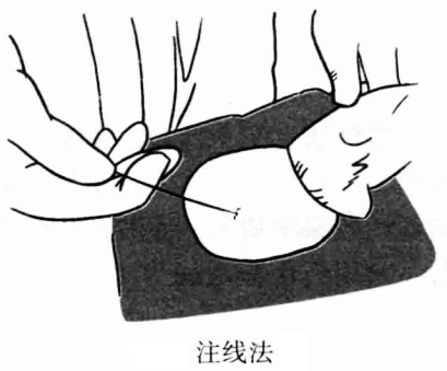 注线法