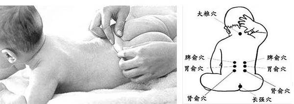 捏脊