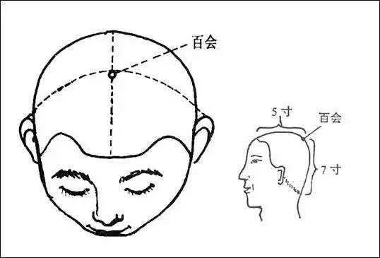 百会穴