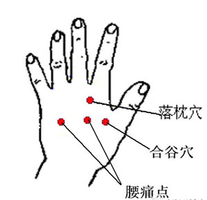 落枕穴