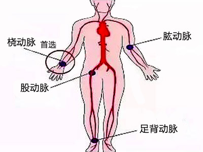 四肢动脉