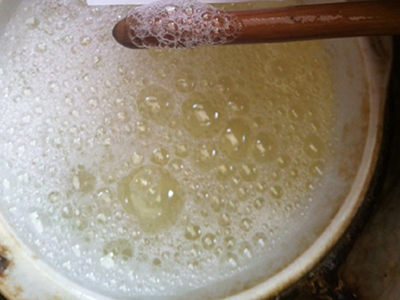 中风尿样